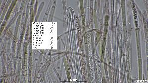 Abgestutztes-Fadenscheibchen_Vibrissea-truncorum_20260419-64941_Sporen_100x_Kongorot_mM_04-04-26_20-25-34.jpg