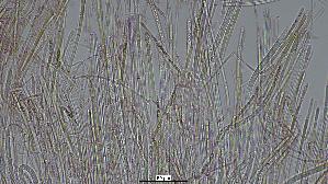 Abgestutztes-Fadenscheibchen_Vibrissea-truncorum_20260419-64941_Sporen_100x_Kongorot_oM_04-04-26_20-25-34.jpg