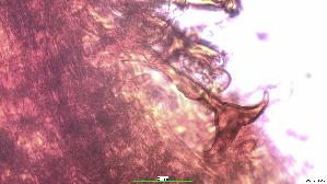 Flacher-Schillerporling_Inonotus-cuticularis_20260728-44054_ankerfoermige-Sete_100x_Kongorot_oM_28-07-26_22-31-01.jpg