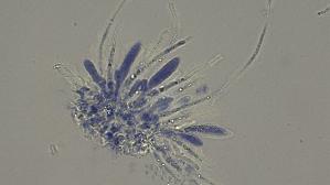 Pfingstrosen---Spaltlippe_Lophodermium-paeoniae_20260317-57396_Asci-Paraphysen_100x_Baumwollblau_oM_17-03-26_20-38-18.jpg