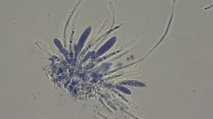 Pfingstrosen---Spaltlippe_Lophodermium-paeoniae_20260317-57396_Asci-Paraphysen_100x_Baumwollblau_oM_17-03-26_20-38-42.jpg