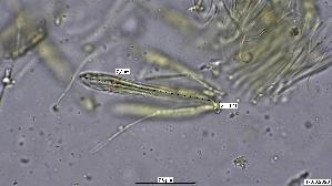 Pfingstrosen---Spaltlippe_Lophodermium-paeoniae_20260317-57396_Asci-Paraphysen_100x_Wasser_mM_17-03-26_21-22-50.jpg