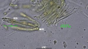 Pfingstrosen---Spaltlippe_Lophodermium-paeoniae_20260317-57396_Asci-Paraphysen_100x_Wasser_mM_17-03-26_21-41-09.jpg