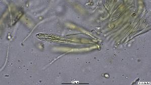 Pfingstrosen---Spaltlippe_Lophodermium-paeoniae_20260317-57396_Asci-Paraphysen_100x_Wasser_oM_17-03-26_21-20-18.jpg