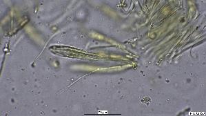Pfingstrosen---Spaltlippe_Lophodermium-paeoniae_20260317-57396_Asci-Paraphysen_100x_Wasser_oM_17-03-26_21-21-08.jpg