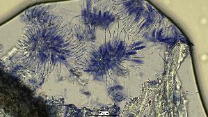 Pfingstrosen---Spaltlippe_Lophodermium-paeoniae_20260317-57396_Asci-Paraphysen_40x_Baumwollblau_oM_17-03-26_20-28-38.jpg