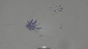 Pfingstrosen---Spaltlippe_Lophodermium-paeoniae_20260317-57396_Asci-Paraphysen_40x_Baumwollblau_oM_17-03-26_20-36-10.jpg