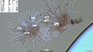 Pfingstrosen---Spaltlippe_Lophodermium-paeoniae_20260317-57396_Asci-Paraphysen_40x_Kongorot_mM_17-03-26_19-32-45.jpg