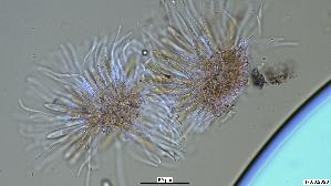 Pfingstrosen---Spaltlippe_Lophodermium-paeoniae_20260317-57396_Asci-Paraphysen_40x_Kongorot_oM_17-03-26_19-28-05.jpg