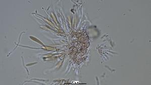 Pfingstrosen---Spaltlippe_Lophodermium-paeoniae_20260317-57396_Asci-Paraphysen_40x_Kongorot_oM_17-03-26_19-53-02.jpg