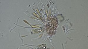 Pfingstrosen---Spaltlippe_Lophodermium-paeoniae_20260317-57396_Asci-Paraphysen_40x_Kongorot_oM_17-03-26_19-57-57.jpg