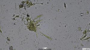 Pfingstrosen---Spaltlippe_Lophodermium-paeoniae_20260317-57396_Asci-Paraphysen_40x_Wasser_oM_17-03-26_23-21-32.jpg
