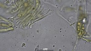 Pfingstrosen---Spaltlippe_Lophodermium-paeoniae_20260317-57396_hakenförmige-Paraphysen_100x_Wasser_oM_17-03-26_21-25-49.jpg